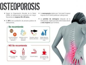 pro-y-contra-de-la-osteoporosis